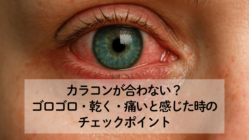 カラコンが合わない？ゴロゴロ・乾く・痛いと感じた時のチェックポイント